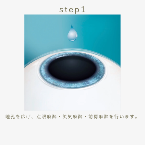 手術方法step1