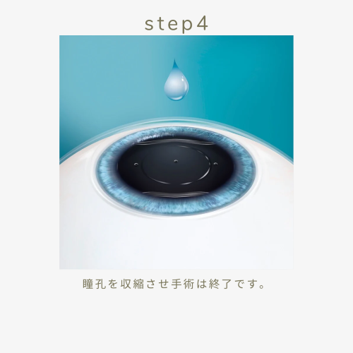 手術方法step4